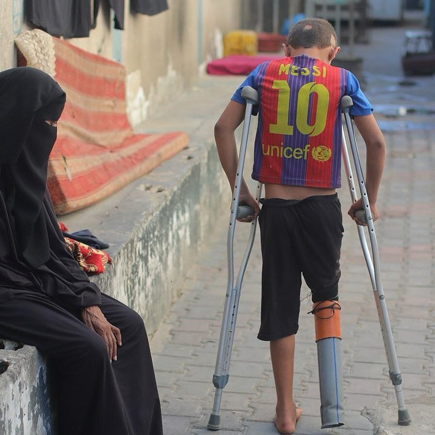 مسی یک پا دل بارساییها را به درد آورد! + عکس