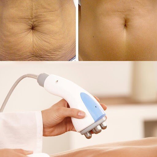 بهترین روشها برای کاهش چربیهای موضعی