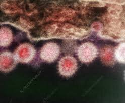 داروی پیشگیری از تب کریمهکنگو به دست آمد