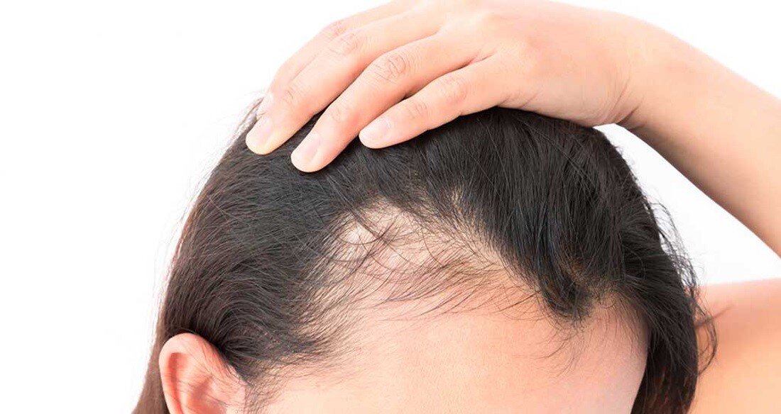 آیا استفاده از شامپو بچه برای جلوگیری از ریزش مو مؤثر است؟