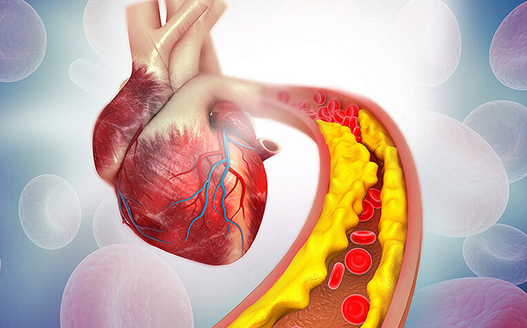 میخواهید انرژی و استقامت بیشتری داشته باشید؟ به قلب خود تمرین دهید کلسترول - قلب
