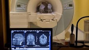 رازهای نهفته در مغز انسان | از اوتیسم تا آلزایمر