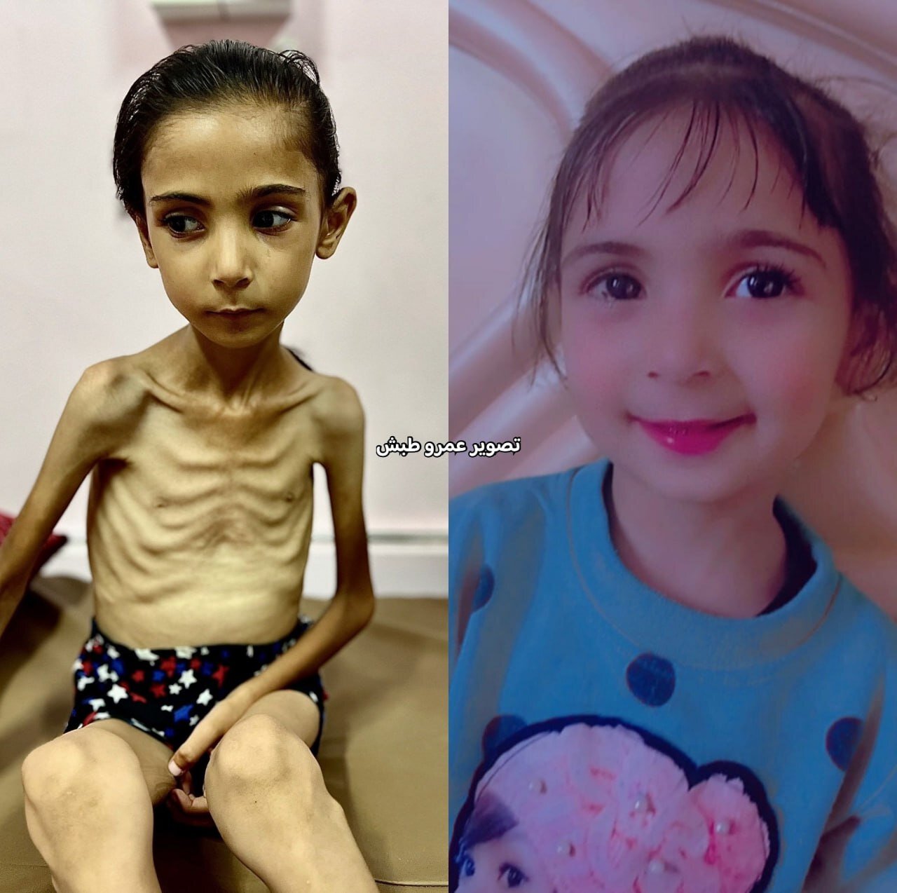 داستان های غزه |گزارش تصویری