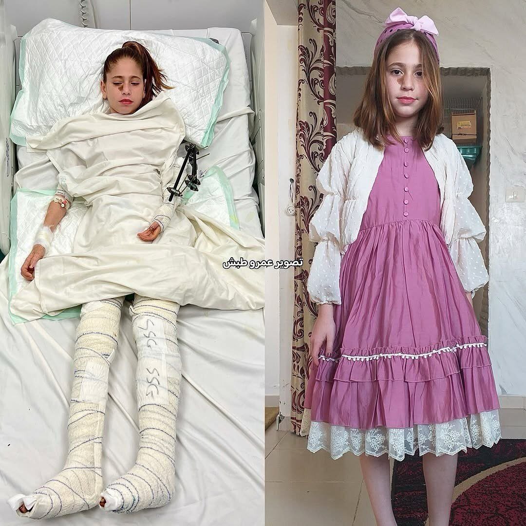 داستان های غزه |گزارش تصویری