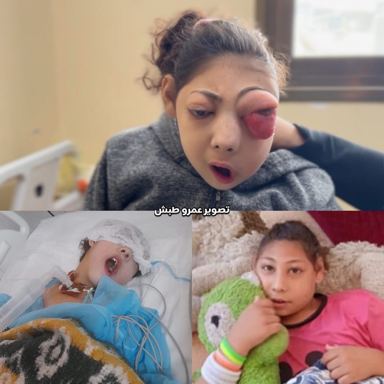 داستان های غزه |گزارش تصویری