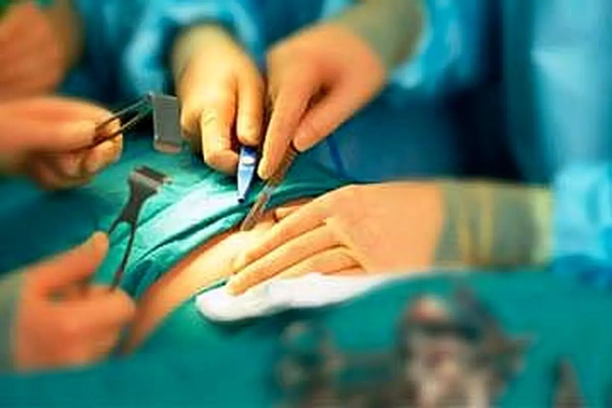 هشدار درباره پیکرتراشی در مراکز غیرمجاز 
