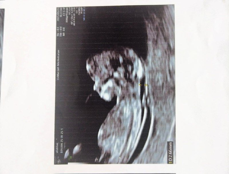 «جاندلم» فرزندش را ندید و رفت