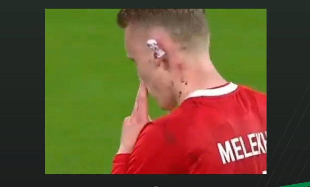 گوش بازیکن روس با خطای جهانبخش پاره شد! + عکس | تصویری جدید از صحنه خشن