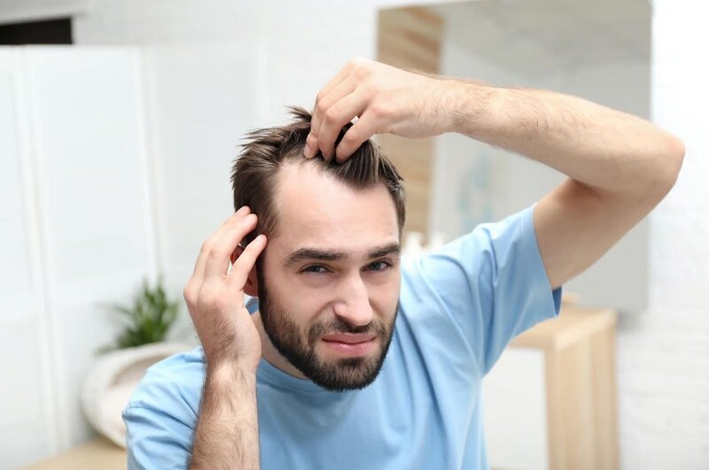 این داروی درمان ریزش مو باعث ایجاد افکار خودکشی میشود طاسی