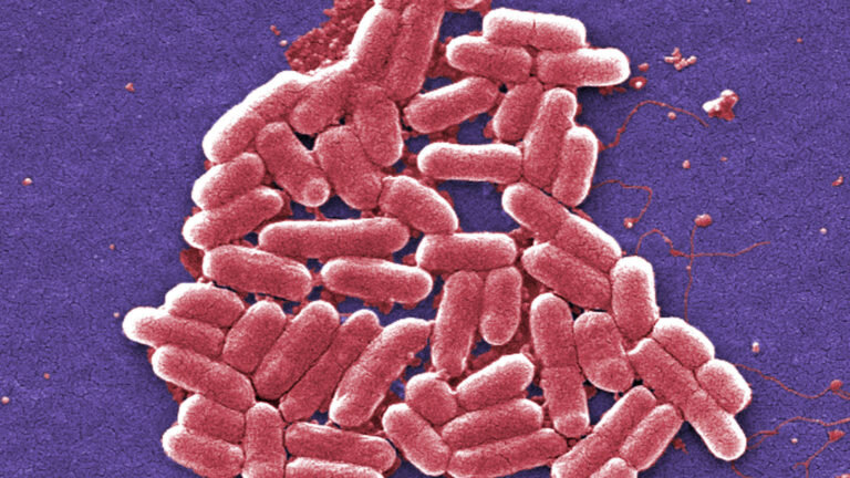 SUPERBUG