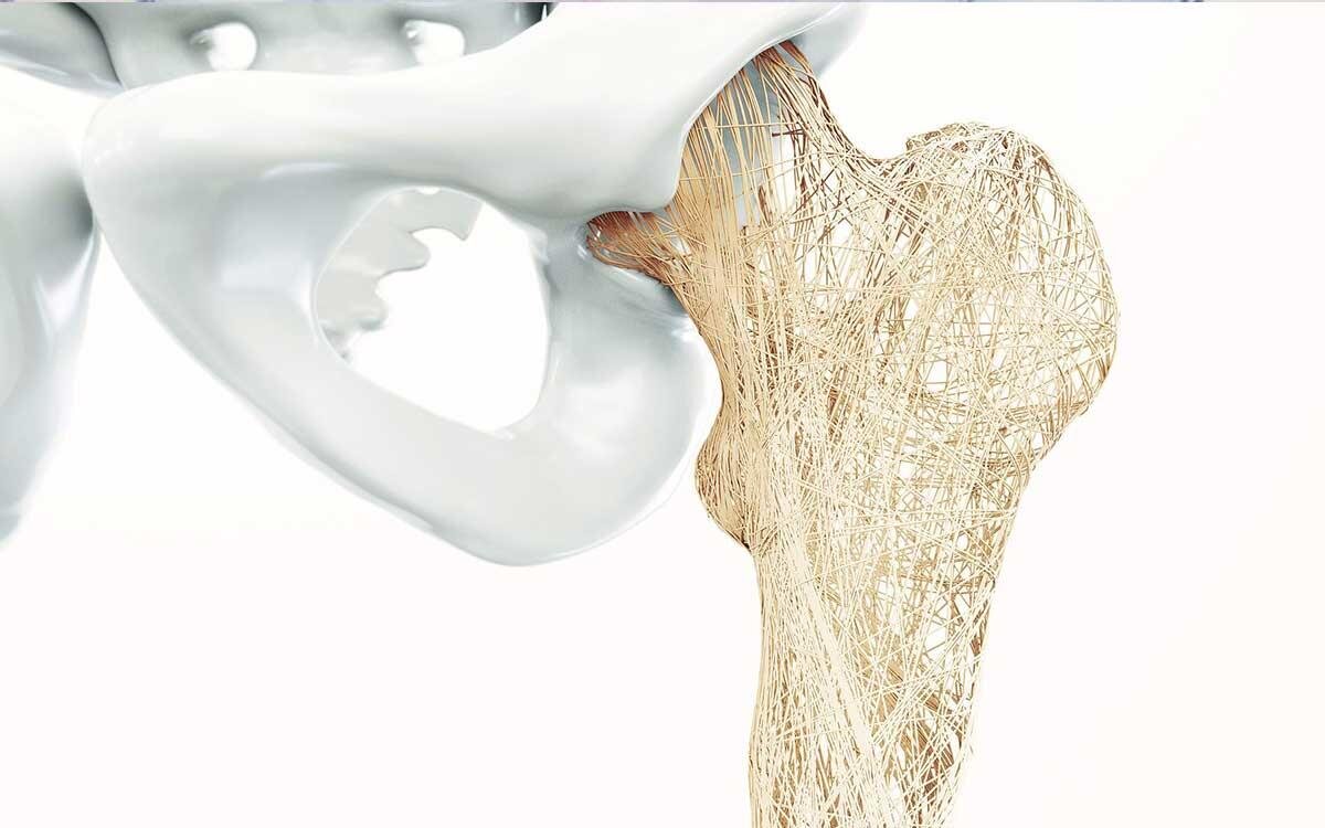 فقط ۲۰ درصد ایرانیهای بالای ۵۰ سال استخوان سالم دارند| بهترین ورزش برای پیشگیری از پوکی استخوان