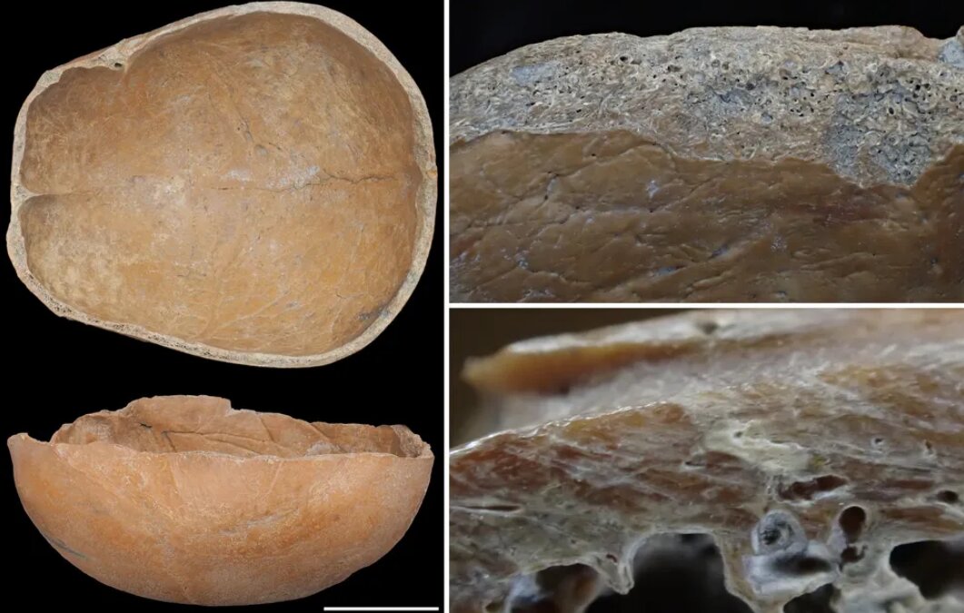 راز جمجمه هایی که تبدیل به ظرف شدند