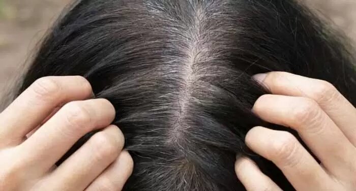 آیا موهای سفید دوباره سیاه میشوند؟ سفید شدن موها
