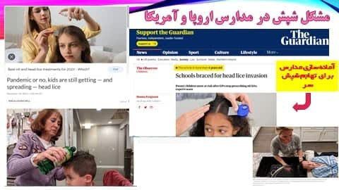 واقعیت شوکهکننده ؛ در آکسفورد شپش عادی است! | خیلی کار خوبی کردم برگشتم ایران