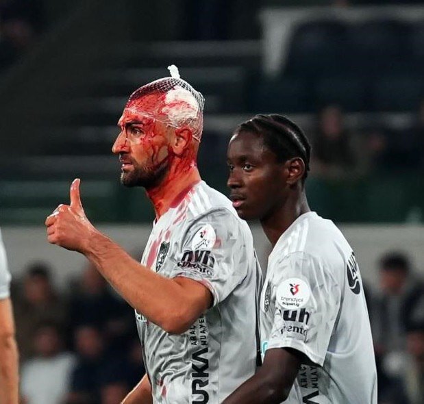 اولین تصاویر از سر خونین سردار دورسون | ویدئو