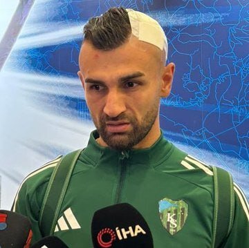 اولین تصاویر از سر خونین سردار دورسون | ویدئو