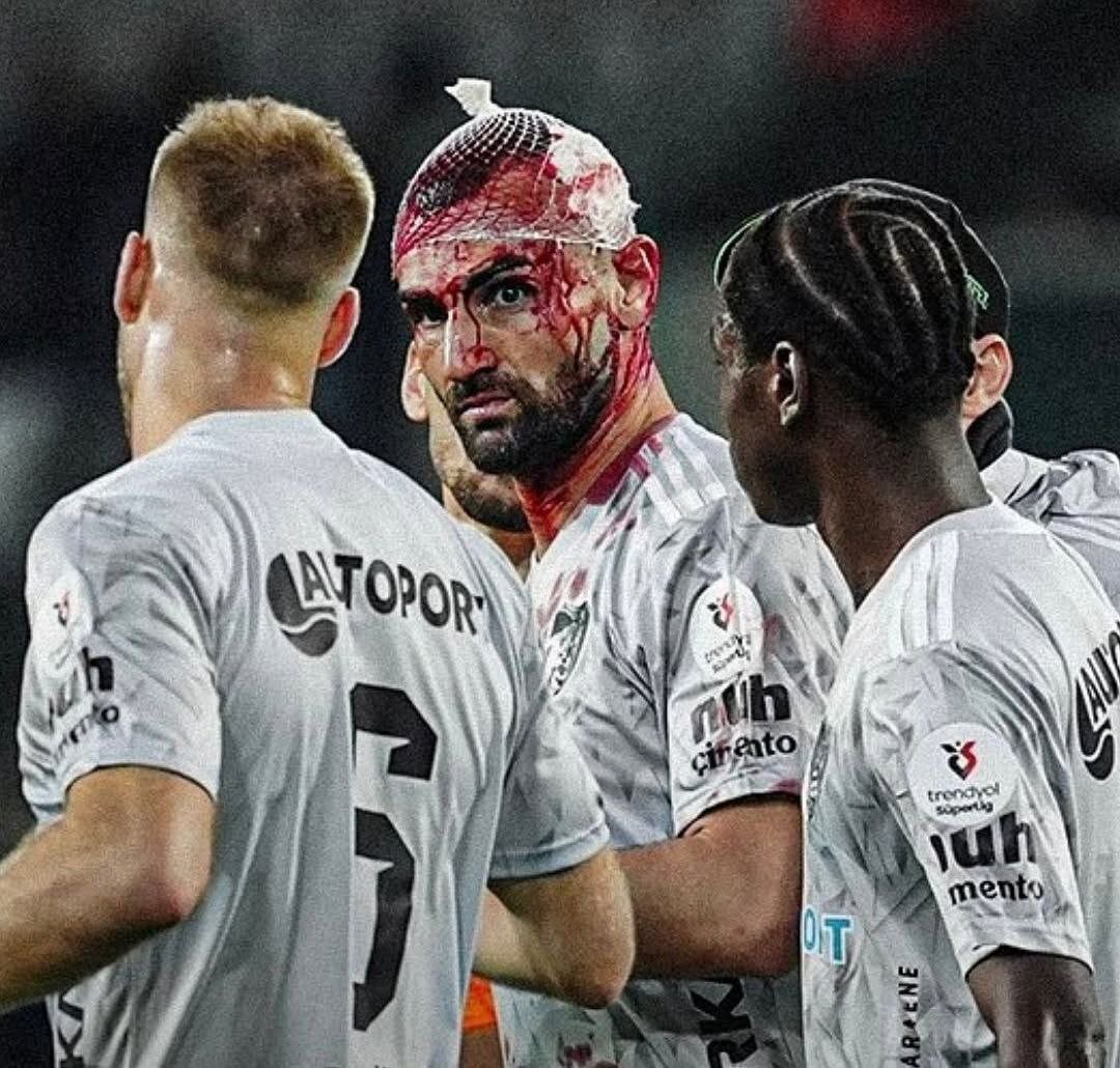 اولین تصاویر از سر خونین سردار دورسون | ویدئو