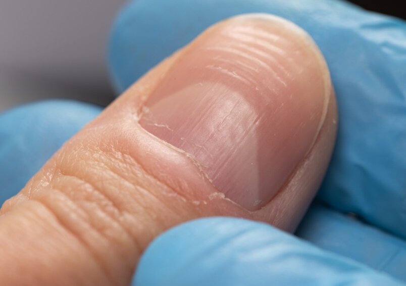 5267605.jpg?ts=1762177064000