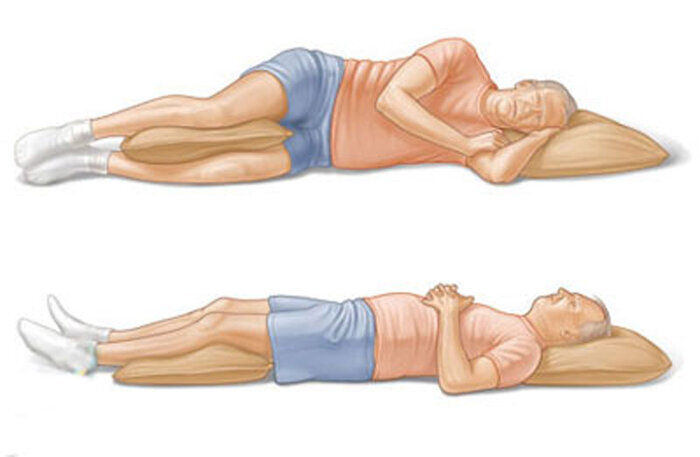 چند تمرین ساده برای اصلاح گودی کمر؛ شایع ترین علت کمردرد
