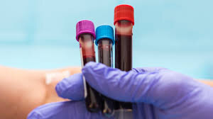 گروه خونی AB بیشتر در معرض مشکلات حافظه و تفکر قرار دارند!