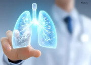 ۴ خوراکی ویژه برای روزهای آلوده