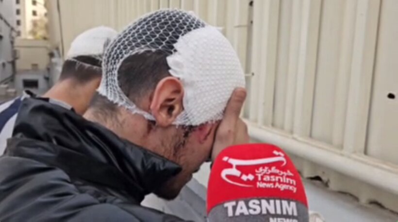 اولین تصاویر موبایل‌قاپ‌های شهرک غرب با سرهای باندپیچی شده! | ویدئو