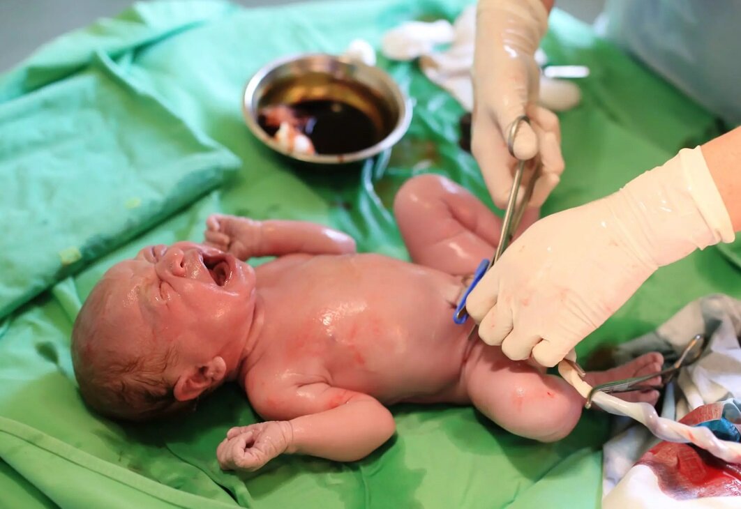 امید تازه برای درمان فلج مغزی کودکان و آرتروز | اولین مرکز زیست‌پزشکی جهان در ایران راه‌اندازی می‌شود