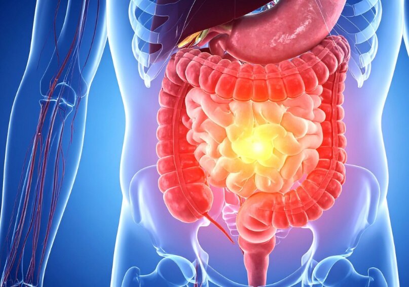 چطور زندگی کنیم بیماری قلبی نگیریم؟