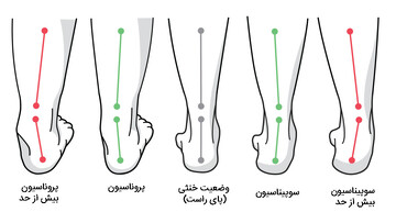 وضعیت-های-قرارگیری-پا.jpg