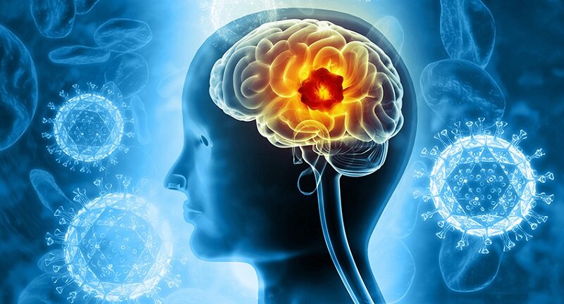 سرطان مغز