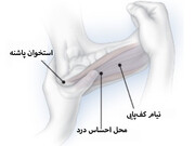 درمان‌های خانگی برای درد پاشنه پا