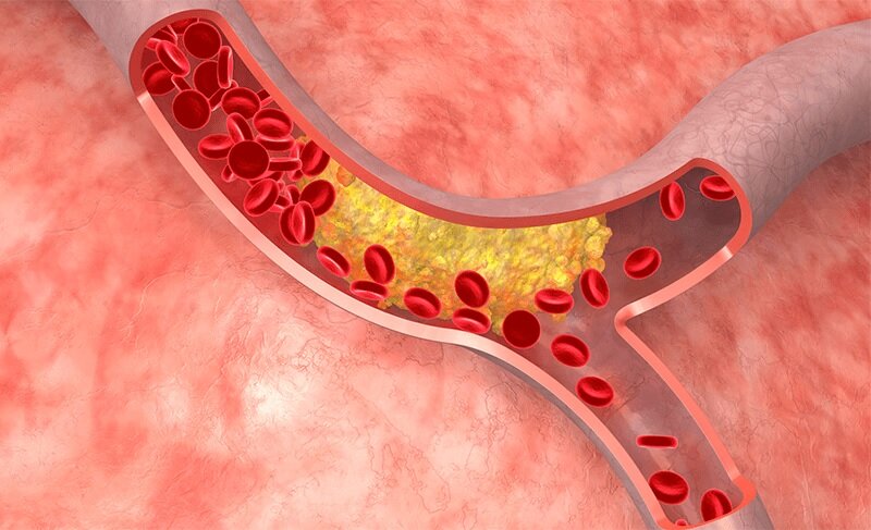 چی بخوریم چربی خون پایین بیاید؟ ؛ فواید دمنوش چای سبز برای کاهش چربی خون