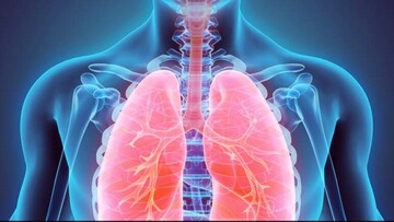 چه کسانی بیشتر در برابر آلودگی هوا آسیب‌پذیرتر هستند؟