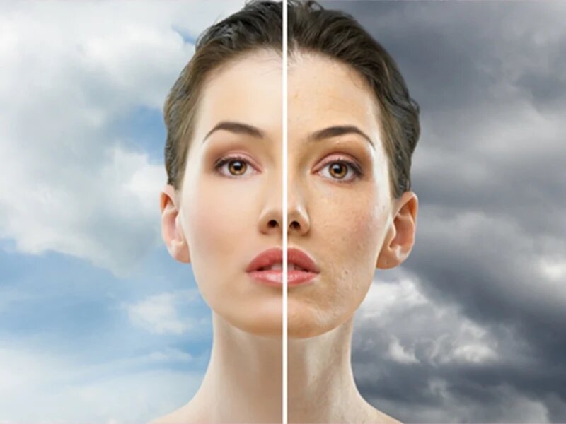 سرطان پوست در کمین شهرهای آلوده؛ هشدار و راهکارهای یک متخصص