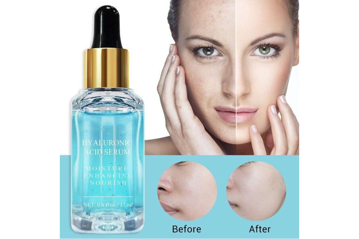 هیالورونیک اسید ؛ راز پوست شاداب و جوان