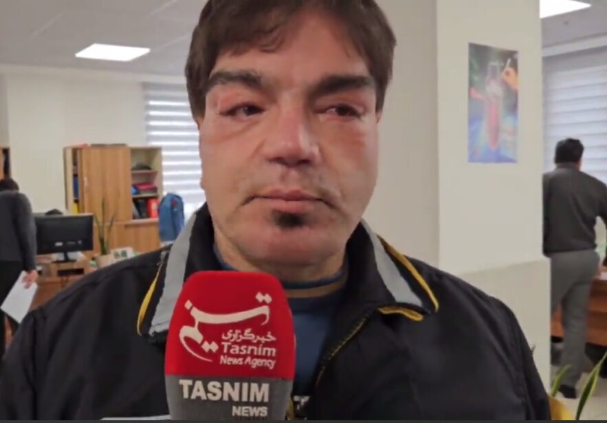 اولین تصویر از مردی که عمل بلفارو کرده بود + ویدئو | بی خیال عربلو نمی‌شوم | ۹ بار به اتاق بیهوشی رفتم