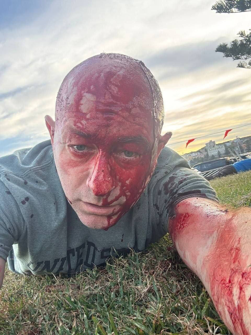 سلفی عجیب بانی جشن یهودیان استرالیا در زمان حمله + عکس