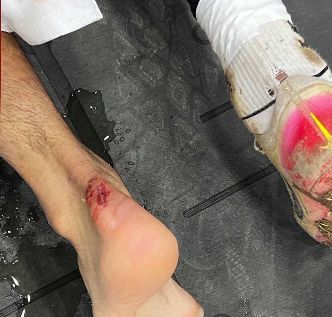 باشگاه خیبر: ببینید مهاجم استقلال با بازیکن ما چه کرد + عکس