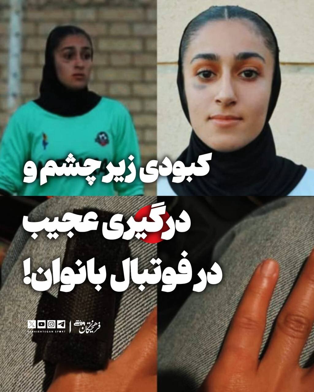 درگیری شدید و فیزیکی تیم بانوان پرسپولیس؛ کبودی چشم بعد از حمله با لگد + عکس