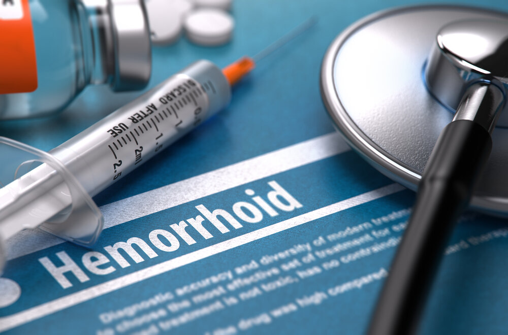 hemorroids