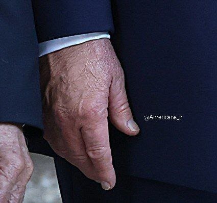 وضعیت رنگ دست ترامپ در دیدار با نتانیاهو دوباره جلب توجه کرد | تصاویر