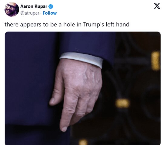 شایعات در مورد سلامتی ترامپ دوباره بالا گرفت + تصویر