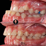 ارتودنسی بدون جراحی فک؛ مرز بین درمان علمی و توقع غیرواقعی بیماران