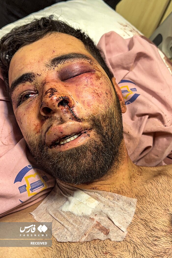 تصاویر دردناک از وضعیت وحشتناک مجروحان حملات داعشی‌وار به مردم