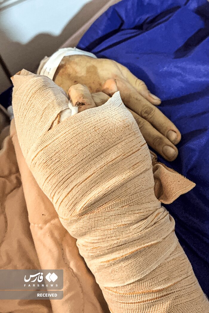 تصاویر دردناک از وضعیت وحشتناک مجروحان حملات داعشی‌وار به مردم