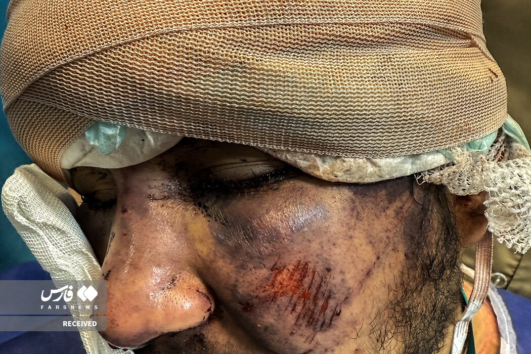 تصاویر دردناک از وضعیت وحشتناک مجروحان حملات داعشی‌وار به مردم