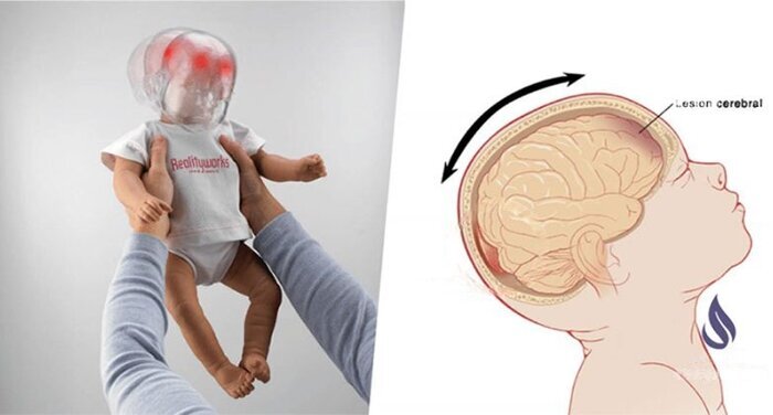 پرتاب به هوا کودک؛‌ بازی ساده ای که جان کودک شما را تهدید می کند