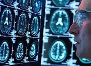 شمارش معکوس برای پایان عصر شیمی‌درمانی؛ فرمان مرگ برای سلول‌های سرطانی