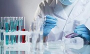تولید موفق کیت‌های آزمایشگاهی دانش‌بنیان | کوتاه از دنیای فناوری