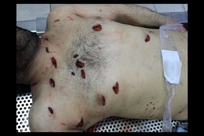 (۱۶+) تصاویری از حمله به ارگان‌های حیاتی بدن در آشوب های اخیر | دیدن این تصاویر برای همه جایز نیست